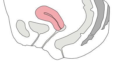 schéma utérus anteversé