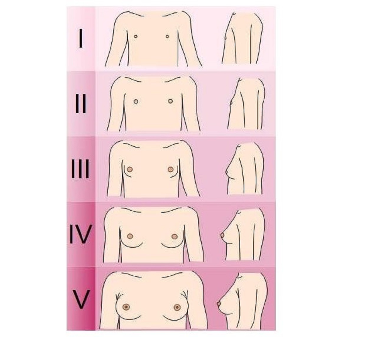schéma stade pubertaire de la poitrine chez la fille