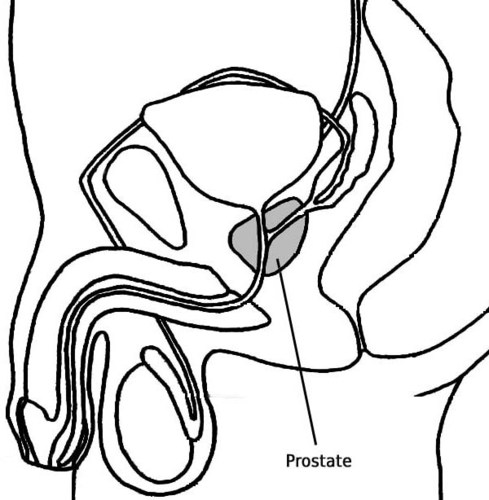 schéma location prostate